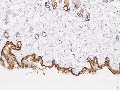 Immunohistochemistry-Paraffin: Cytokeratin 10 Antibody [NBP2-99090]