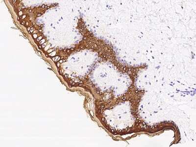 Immunohistochemistry-Paraffin: Cytokeratin 10 Antibody [NBP2-99090]