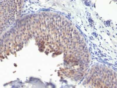 Immunohistochemistry-Paraffin: Cytokeratin 10 Antibody (KRT10/1275) [NBP2-44708]