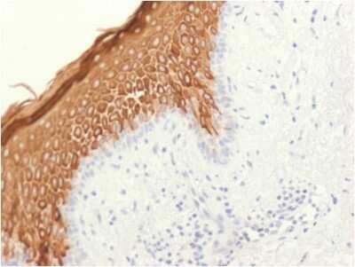 Immunohistochemistry-Paraffin: Cytokeratin 10 Antibody (KRT10/1948R) - Azide and BSA Free [NBP3-08716]