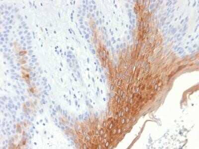 Immunohistochemistry-Paraffin: Cytokeratin 10 Antibody (KRT10/1990R) [NBP2-75765]