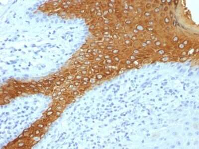 Immunohistochemistry-Paraffin: Cytokeratin 10 Antibody (KRT10/844 + KRT10/1275) - Azide and BSA Free [NBP2-54327]