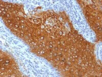 Immunohistochemistry-Paraffin: Cytokeratin 10 Antibody (KRT10/844) - Azide and BSA Free [NBP2-47825]