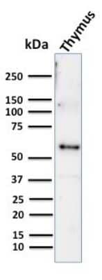 Western Blot: Cytokeratin 10 Antibody (KRT10/844) [NBP2-44707]