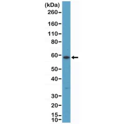 Western Blot: Cytokeratin 10 Antibody (RM386) [NBP2-89092]