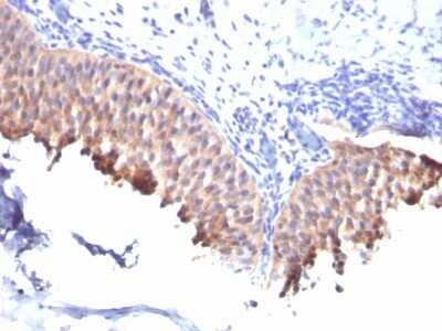 Immunohistochemistry-Paraffin: Cytokeratin 10 Antibody (SPM261) - Azide and BSA Free [NBP2-34752]