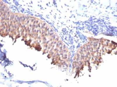 Immunohistochemistry-Paraffin: Cytokeratin 10 Antibody (SPM261) [NBP2-32962]