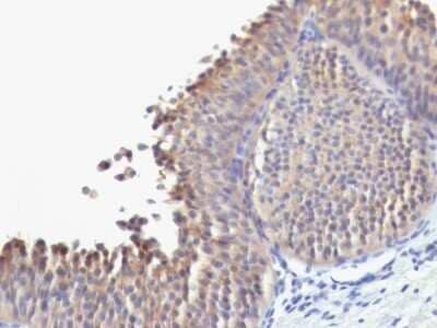 Immunohistochemistry-Paraffin: Cytokeratin 10 Antibody (SPM623) [NBP2-53134]