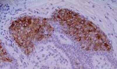 Immunohistochemistry: Cytokeratin 10 Antibody (VIK-10) - BSA Free [NB500-354]