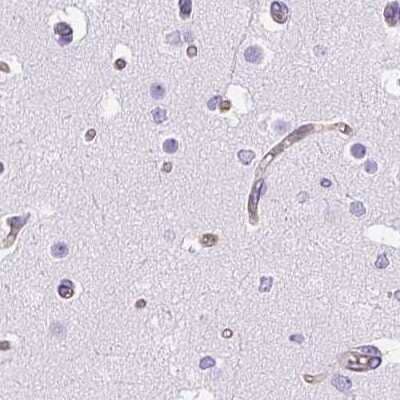 Immunohistochemistry-Paraffin: Cytokeratin 12 Antibody [NBP2-58100]