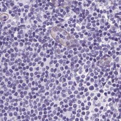 Immunohistochemistry-Paraffin: Cytokeratin 12 Antibody [NBP2-58100]
