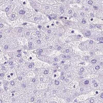 Immunohistochemistry-Paraffin: Cytokeratin 12 Antibody [NBP2-58100]