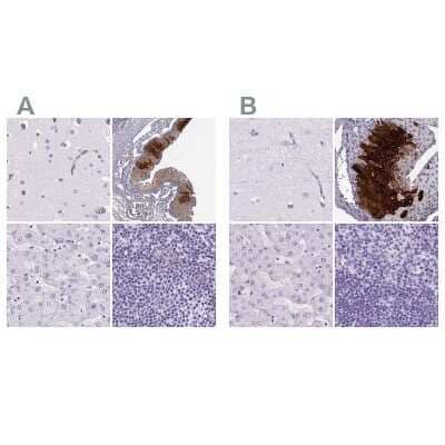 Immunohistochemistry-Paraffin: Cytokeratin 12 Antibody [NBP2-58100]