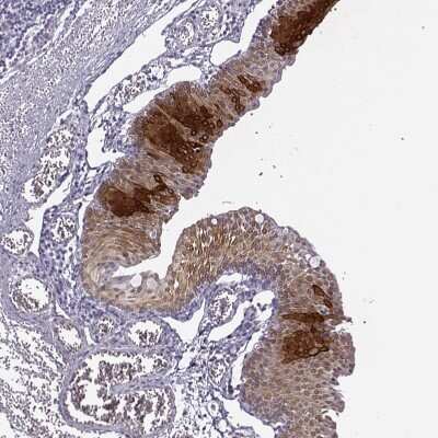 Immunohistochemistry-Paraffin: Cytokeratin 12 Antibody [NBP2-58100]