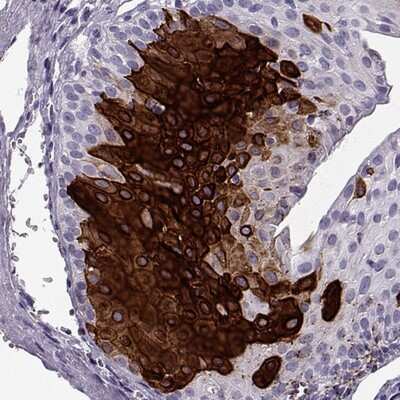 Immunohistochemistry-Paraffin: Cytokeratin 12 Antibody [NBP2-58256]