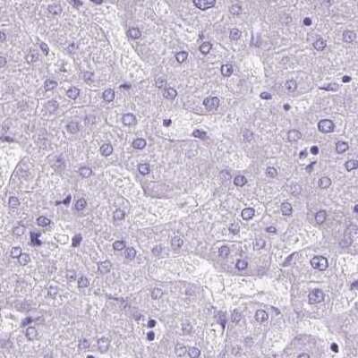 Immunohistochemistry-Paraffin: Cytokeratin 12 Antibody [NBP2-58256]