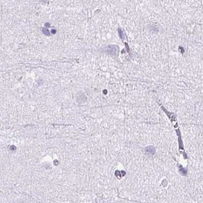 Immunohistochemistry-Paraffin: Cytokeratin 12 Antibody [NBP2-58256]