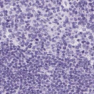 Immunohistochemistry-Paraffin: Cytokeratin 12 Antibody [NBP2-58256]