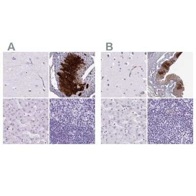 Immunohistochemistry-Paraffin: Cytokeratin 12 Antibody [NBP2-58256]