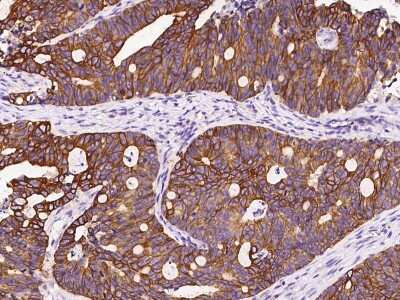 Immunohistochemistry-Paraffin: Cytokeratin 12 Antibody [NBP2-99151]