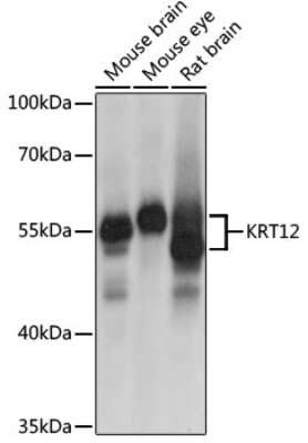 Western Blot: Cytokeratin 12 AntibodyAzide and BSA Free [NBP2-92582]