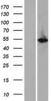 Western Blot: Cytokeratin 12 Overexpression Lysate [NBP2-09047]