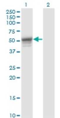 Western Blot: Cytokeratin 13 Antibody (4F5) [H00003860-M05]