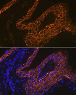 Immunohistochemistry: Cytokeratin 13 Antibody (5M6B10) [NBP3-15261]