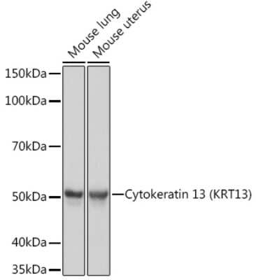 Western Blot: Cytokeratin 13 Antibody (5M6B10) [NBP3-15261]