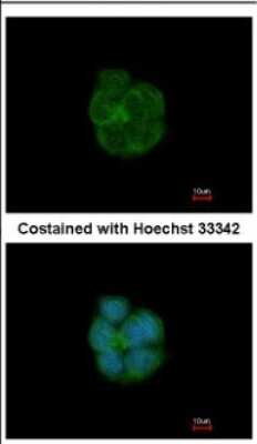 Immunocytochemistry/ Immunofluorescence: Cytokeratin 13 Antibody [NBP2-16086]