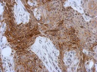 Immunohistochemistry-Paraffin: Cytokeratin 13 Antibody [NBP2-16086]