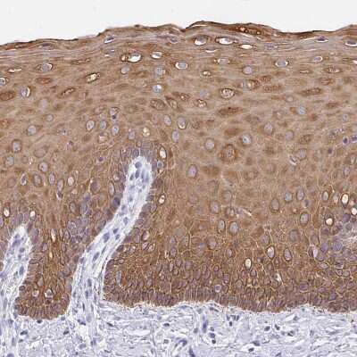 Immunohistochemistry-Paraffin: Cytokeratin 13 Antibody [NBP2-38166]