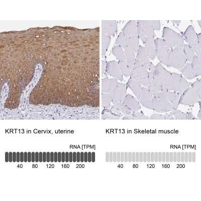 Immunohistochemistry-Paraffin: Cytokeratin 13 Antibody [NBP2-38166]