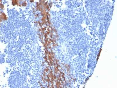 Immunohistochemistry-Paraffin: Cytokeratin 13 Antibody (KRT13/2659) - Azide and BSA Free [NBP3-08284]