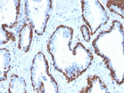 Immunohistochemistry-Paraffin: Cytokeratin 13 Antibody (KRT13/2659) - Azide and BSA Free [NBP3-08284]