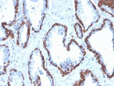 Immunohistochemistry-Paraffin: Cytokeratin 13 Antibody (KRT13/2659) [NBP3-07847]