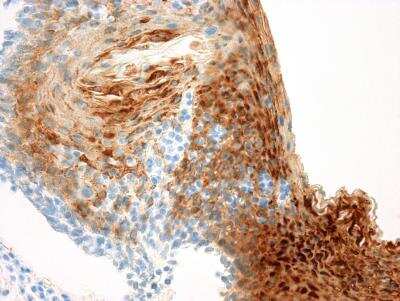 Immunohistochemistry-Paraffin: Cytokeratin 13 Antibody (KS-1A3) [NBP1-22777]