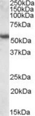 Western Blot: Cytokeratin 13 Antibody [NBP1-06047]