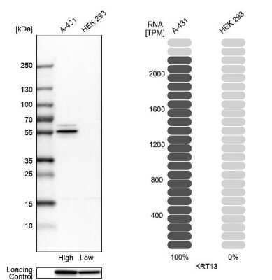 Western Blot: Cytokeratin 13 Antibody [NBP2-38166]