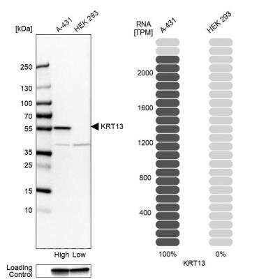 Western Blot: Cytokeratin 13 Antibody [NBP2-68890]