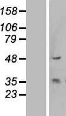 Western Blot: Cytokeratin 13 Overexpression Lysate [NBL1-12380]