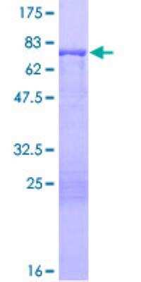 SDS-PAGE: Recombinant Human Cytokeratin 13 GST (N-Term) Protein [H00003860-P01]