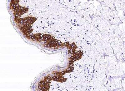 Immunohistochemistry-Paraffin: Cytokeratin 14 Antibody (101) [NBP2-89198]