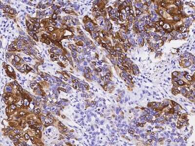Immunohistochemistry-Paraffin: Cytokeratin 14 Antibody (101) [NBP2-89198]