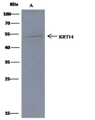Immunoprecipitation: Cytokeratin 14 Antibody (101) [NBP2-89198]