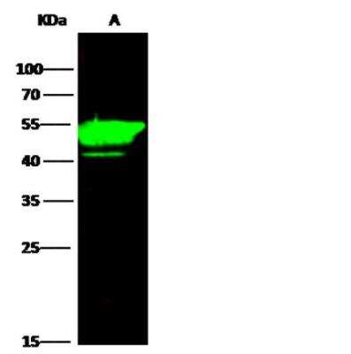 Western Blot: Cytokeratin 14 Antibody (101) [NBP2-89198]