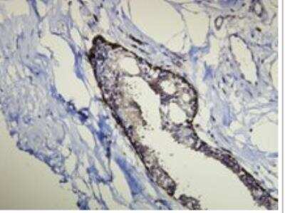 Immunohistochemistry-Paraffin: Cytokeratin 14 Antibody (D19-N) [NBP1-79069]