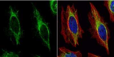 Immunocytochemistry/ Immunofluorescence: Cytokeratin 14 Antibody [NBP1-31326]