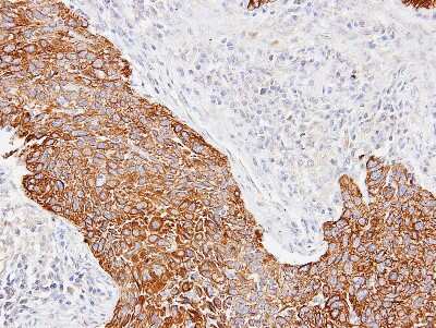 Immunohistochemistry-Paraffin: Cytokeratin 14 Antibody [NBP1-31326]