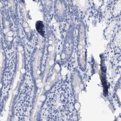 Immunohistochemistry-Paraffin: Cytokeratin 14 Antibody [NBP1-84917]